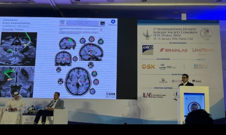 Neurocirugía en CDMX